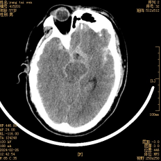 1712885865159029171.png image.png